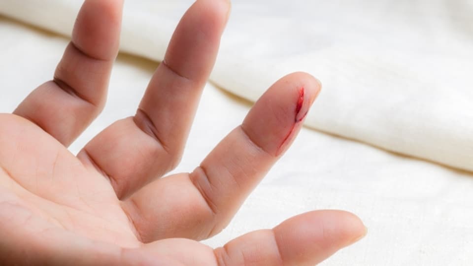 Was Tun Bei Schnittverletzung Finger