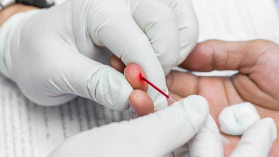 Oft reicht ein kleiner Piks in den Finger, um ein Blutbild zu machen.