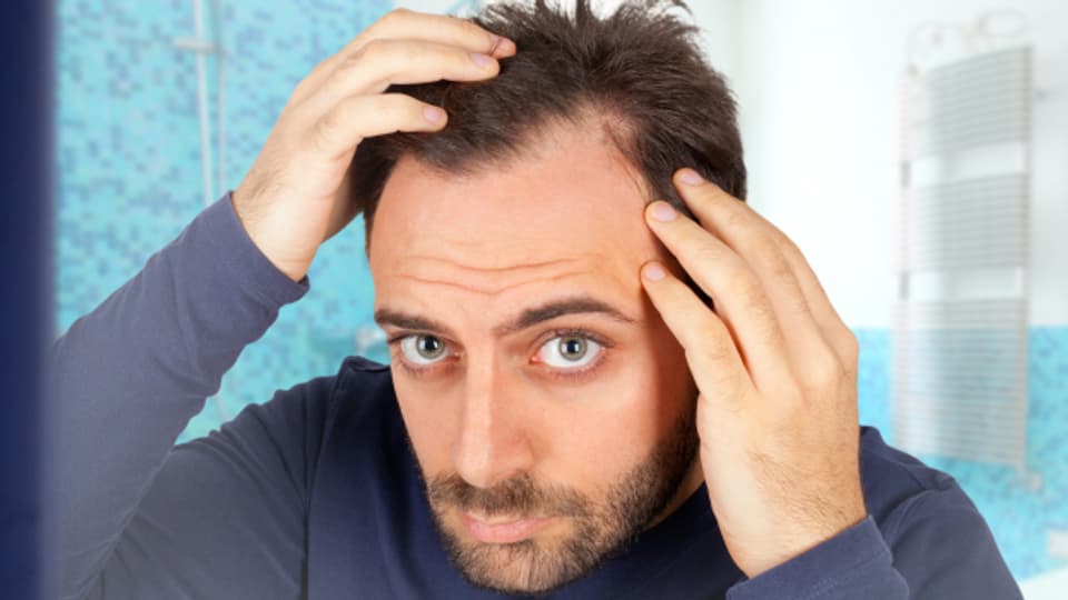 Bei Männern sind es oft die Hormone, welche die Haare lichter werden lassen. Anders bei Frauen.