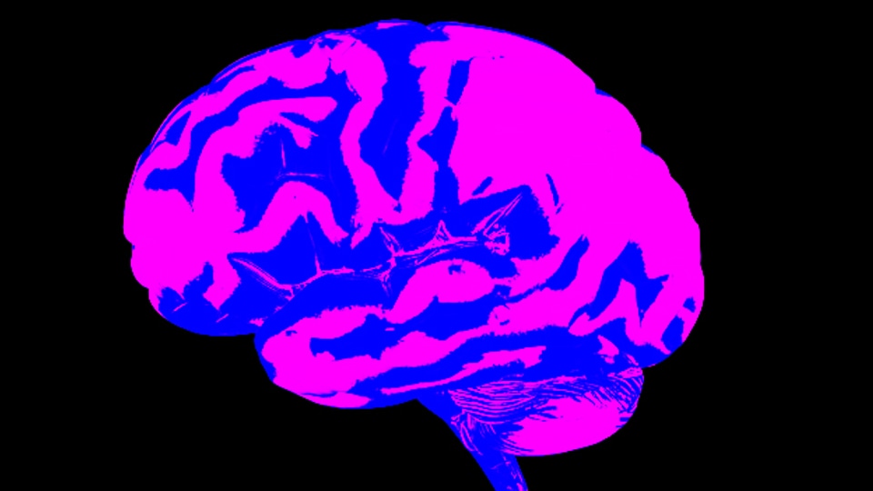 computertomographische Aufnahme des Gehirns