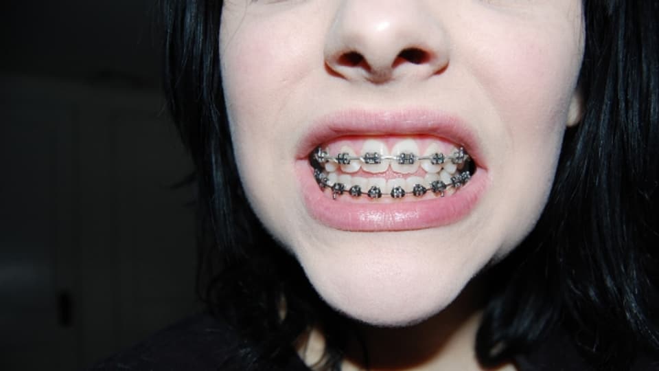 Zähne zeigen kann hip sein.