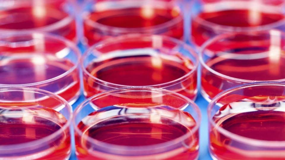 Petrischalen mit Blutproben