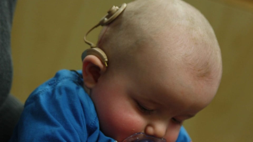 Säugling mit Cochlea-Implantat