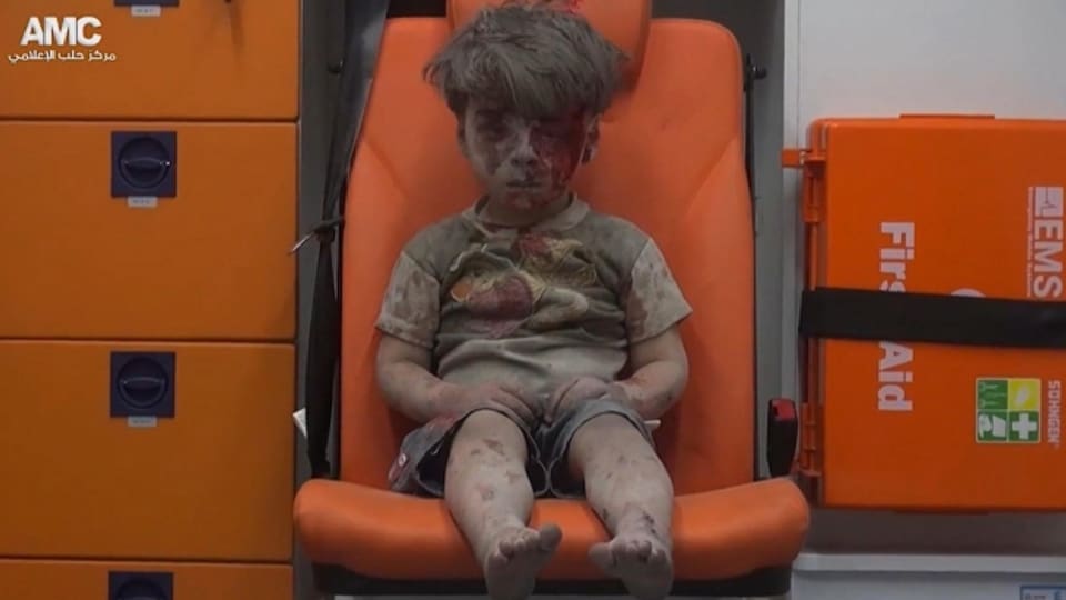 Das Bild dieses verletzten syrischen Jungen ging um die Welt.