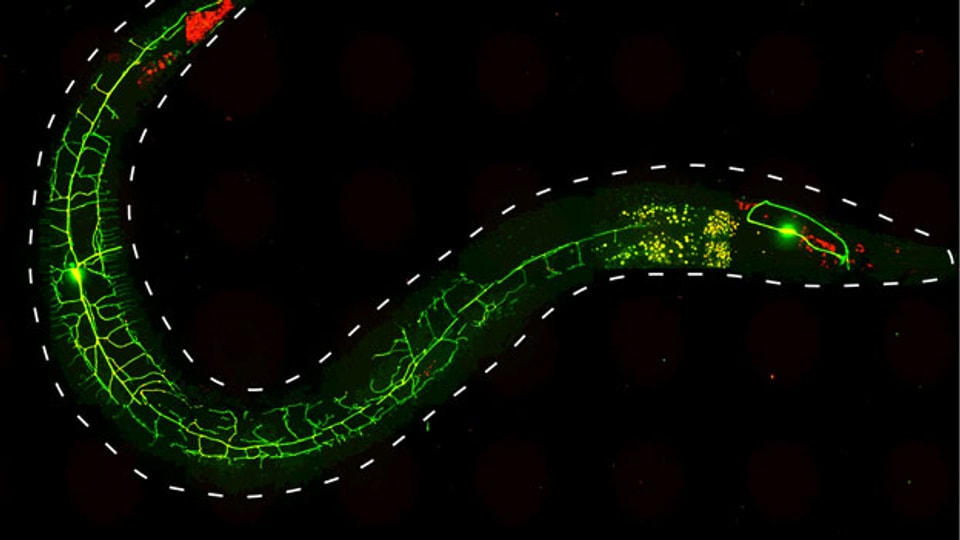 Der Fadenwurm C. elegans gibt dem Menschen Einblick in die komplexesten Prozesse des Lebens: Von der ersten Zellteilung bis zum Tod.