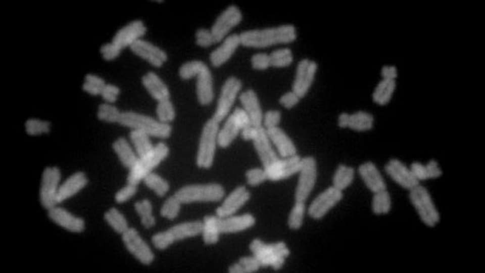 Menschliche Chromosomen: Gibt es bald nur noch das X-Chromosom?
