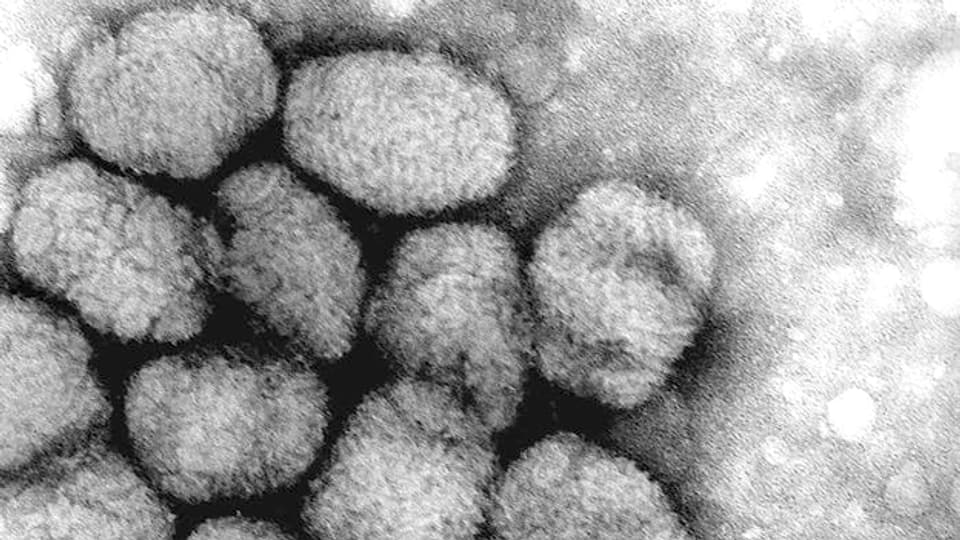 Die Erreger der Pocken beim Menschen sind Viren aus der Gattung Orthopoxvirus.
