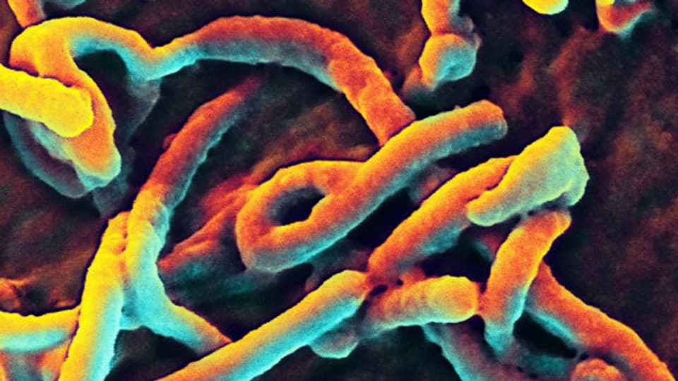 In der Bekämpfung von Ebola gibt es Strukturprobleme.