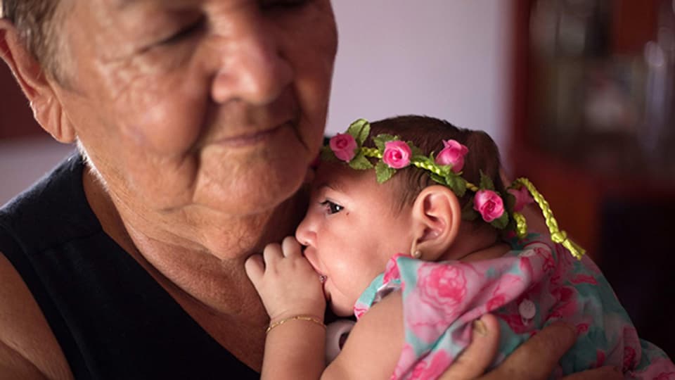 Ein vier Monate altes Kind mit Mikrozephalie im brasilianischen Pernambuco, Februar 2016.
