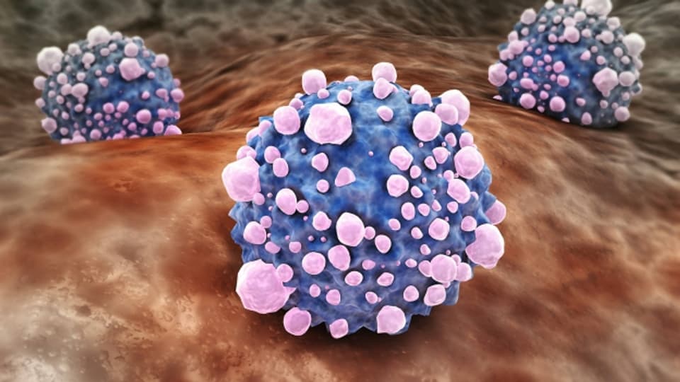 Krebszellen sollen durch das Immunsystem bekämpft werden.