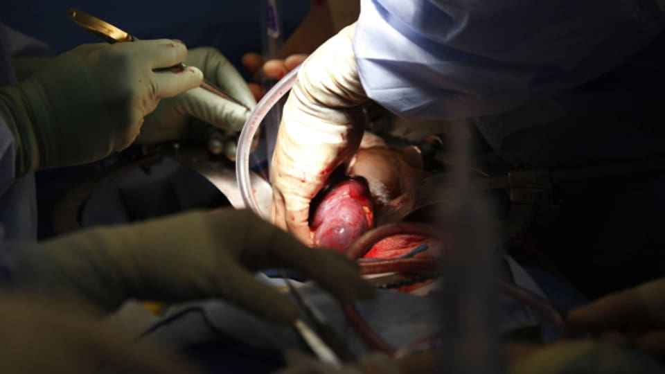 Ärzte in den USA haben erstmals einem lebenden Patienten eine Schweineniere transplantiert. (Symbolbild)
