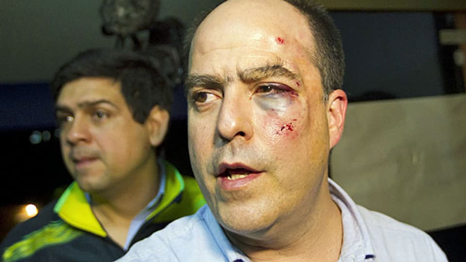 Ein Abgeordneter der venezolanischen Opposition nach einer Schlägerei im Parlament.