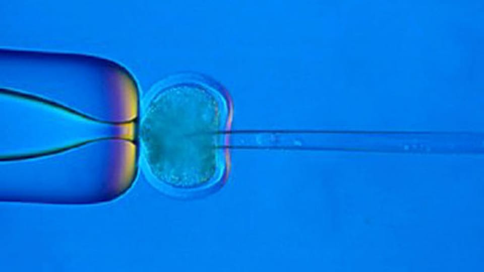 Die Chromosomen im Zellkern einer Eizelle werden im Roslin Institute in Edinburgh in Schottland im Rahmen des Zellkerntransfers. Symbolbild.