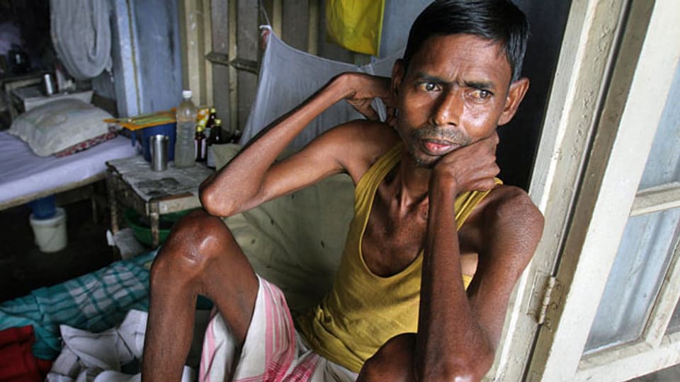 Tuberkulose-Patient Moniram Das im TB-Krankenhaus in Gauhati, Indien. Die Krankheit ist heilbar und sogar verhinderbar. Symbolbild.