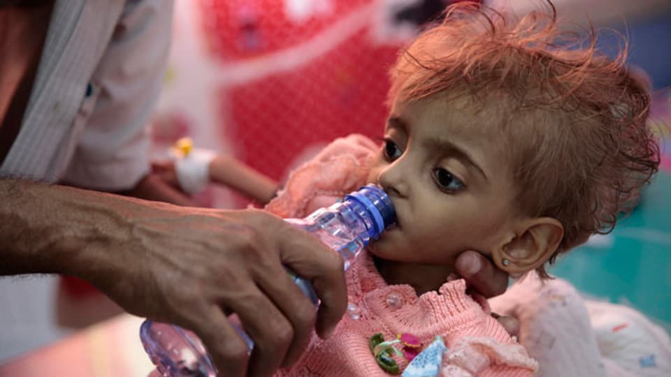Ein Vater gibt seinem unterernährtem Kind in einem Spital in Jemen Wasser zu trinken.