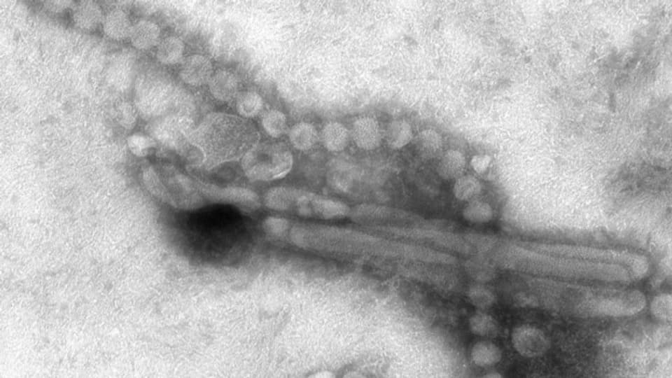 Vogelgrippe-Virus.