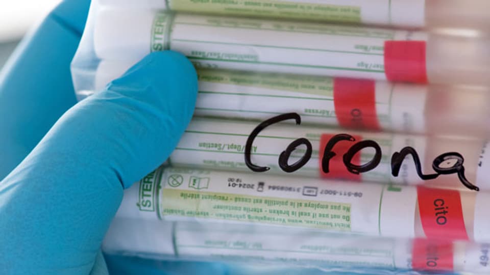 Corona verbreitet sich weltweit. Man will ein Medikament auf der Grundlage von Antikörpern finden. Symbolbild.