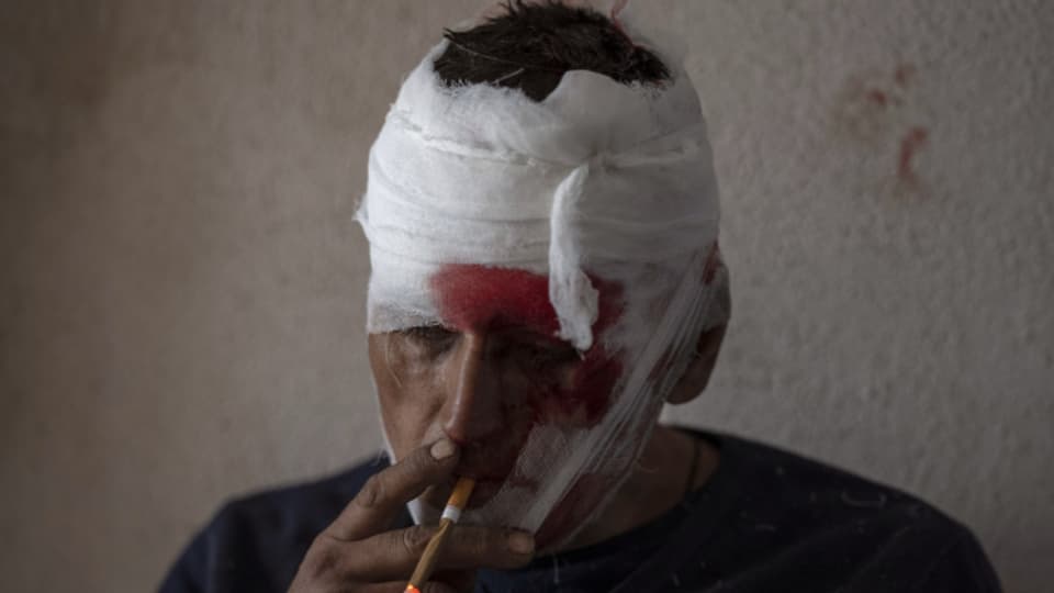Ein verletzter Mann, nach einem russischen Bombenanschlag auf eine Fabrik in Kramatorsk. Haben diese Kriegsbilder und ihre Wirkung eine neue Dimension erreicht?