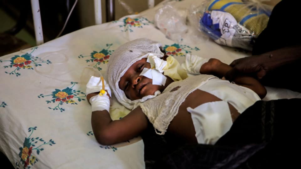 Behandlung eines Kindes, dass durch den Krieg verletzt wurde, in einem Spital ausserhalb der Region Tigray im Osten Äthiopiens.