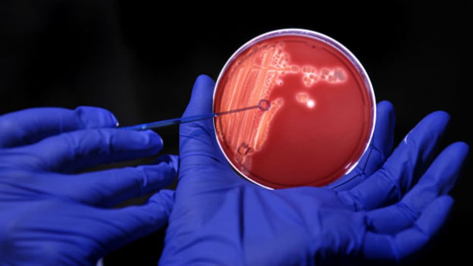 Darm-Bakterien – sie werden besonders oft resistent gegen Antibiotika.