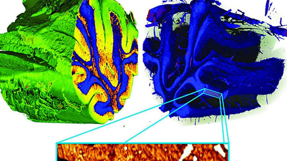 Tiefer Blick ins Kleinhirn: Forschende der Uni Basel schauen mit einem speziellen Röntgenverfahren genau ins Hirn.