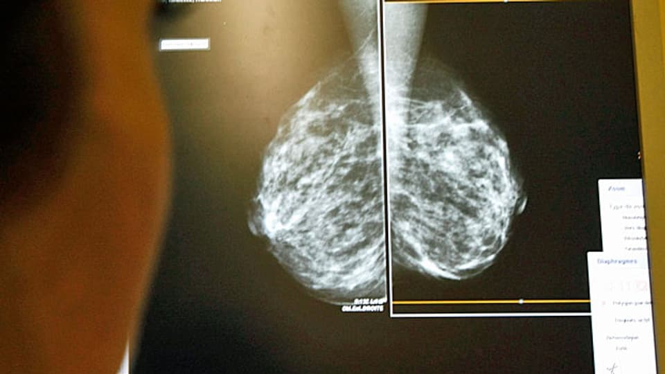 Bild einer Mammografie