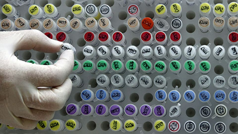 Der Ständerat erlaubt Gen-Untersuchungen an Embryos im Reagenzglas nur in begründeten Fällen.