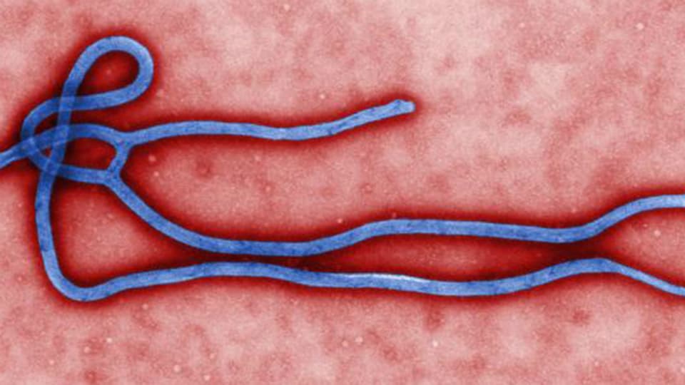 Das Ebola-Virus könnte auch in die Schweiz gelangen.