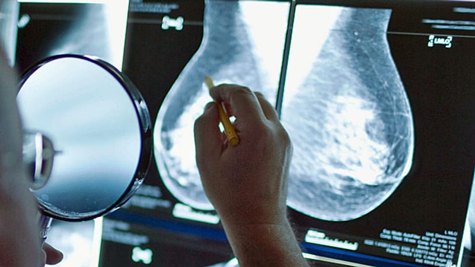 Für den Experten ist die Situation beim Selbstabtasten vergleichbar mit jener beim Mammographie-Screening: Wenig bis kein Nutzen bei gleichzeitigem Schaden.