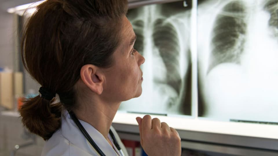 Das routinemässige präoperative Röntgen des Brustkorbs sei unnütz, meint die Schweizerische Gesellschaft für Allgemeine Innere Medizin (SGAIM).