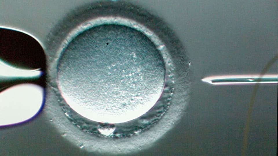 Für die Behindertenverbänden gibt es nur ein Nein zum revidierten Fortpflanzungsmedizin-Gesetz. Bild: Injektion eines Spermiums in eine Eizelle.