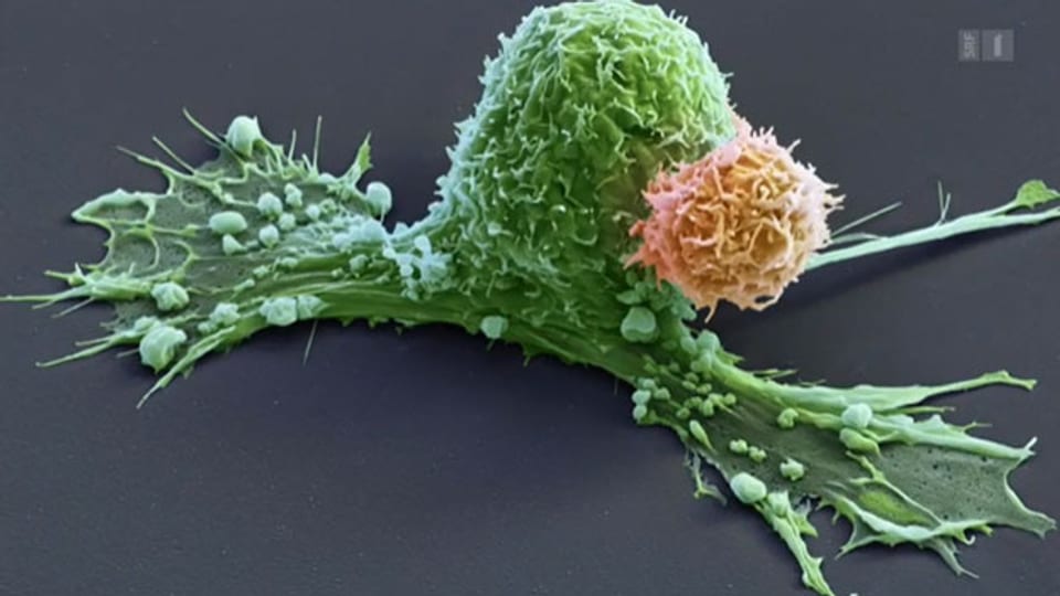 Eine menschliche Immunzelle (orange) greift eine grosse Krebszelle an. Bild: SRF.