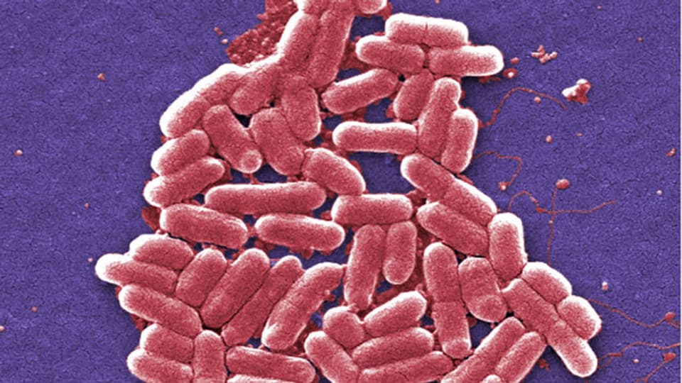 Das Antibiotika-resistente Darmbakterium Escherichia.