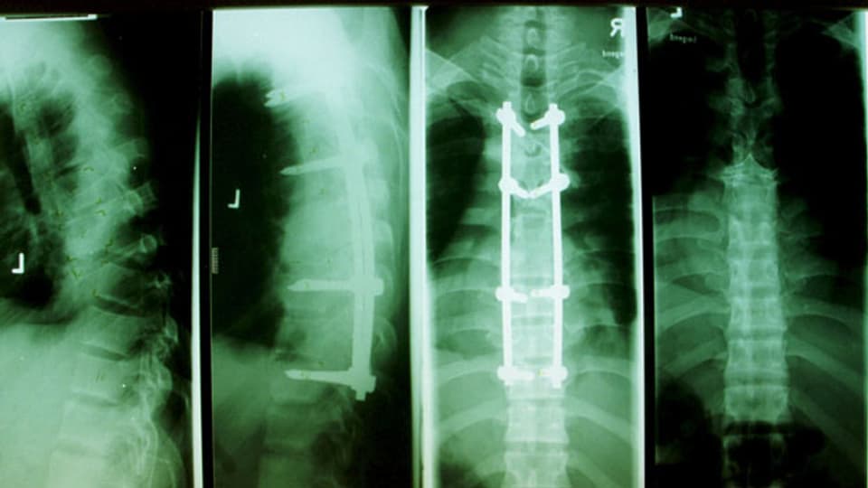 Symbolbild: Röntgenbilder.