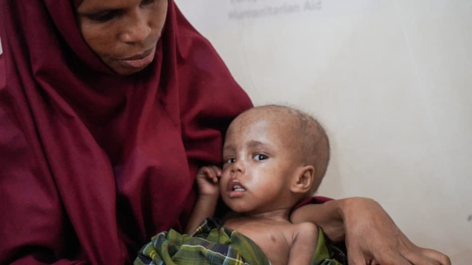 Rund ein Drittel aller Kinder in Somalia sind unterernährt.