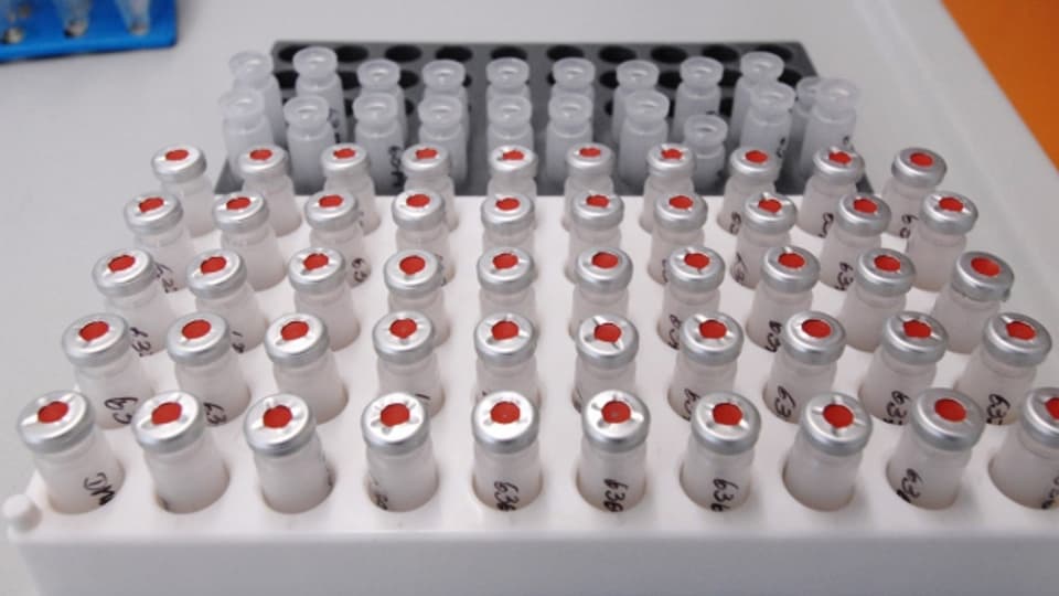 Urinproben stehen bereit zur Doping-Analyse.