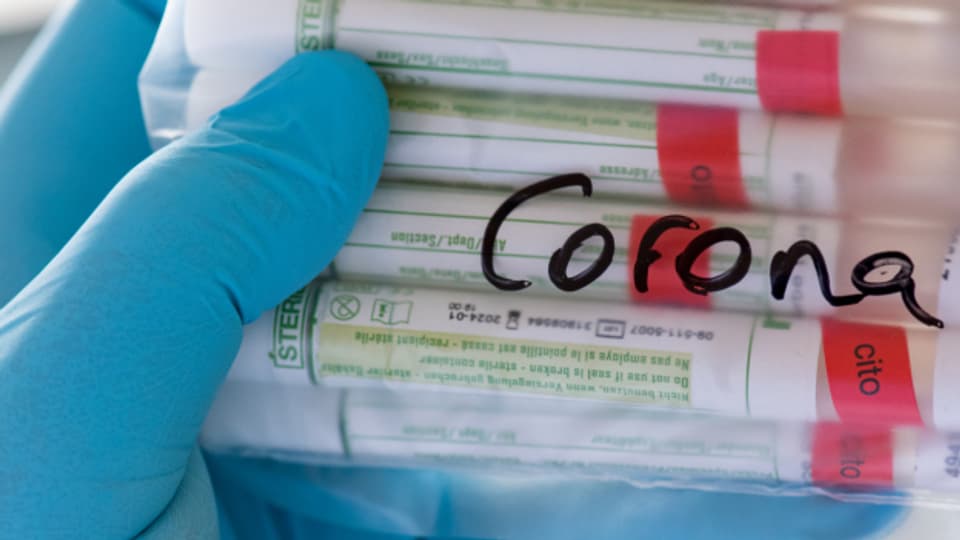 Coronatests vor der Weiterverarbeitung in einem Labor