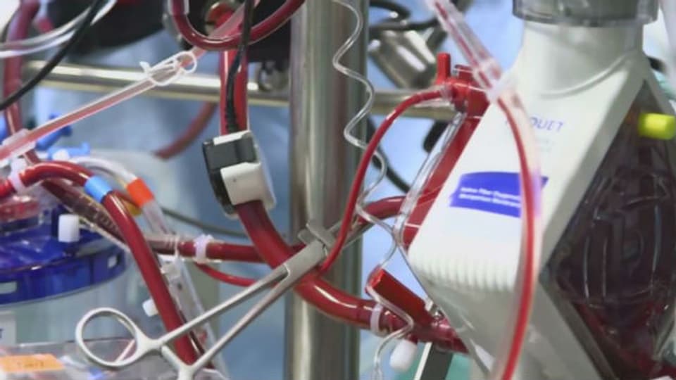 Heute vor als 350 Jahren Erster Versuch einer Bluttransfusion Tageschronik SRF