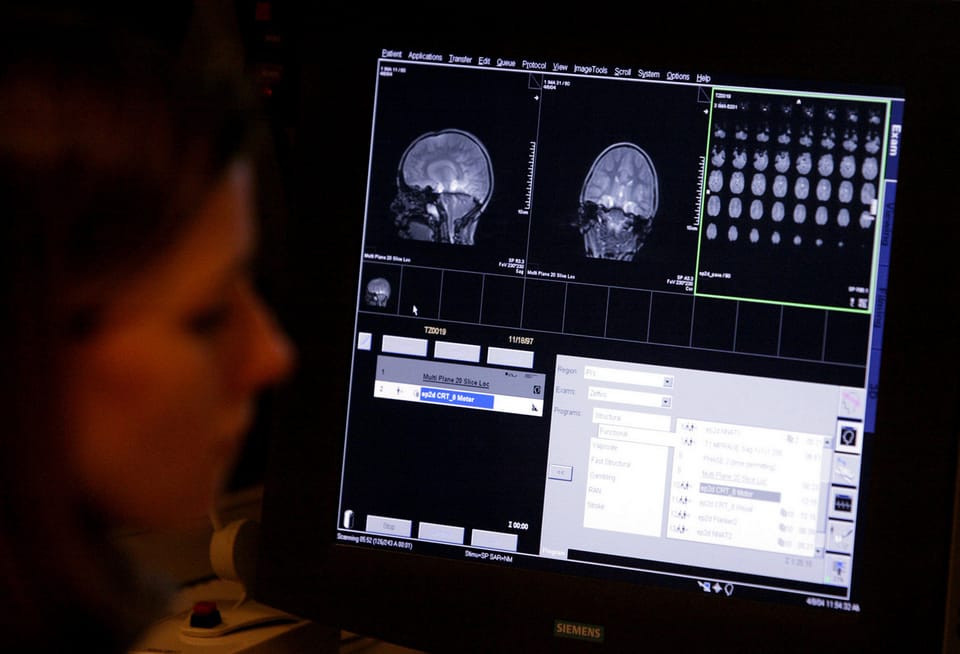 Untersuchung des Gehirns eines autistischen Mädchens an der Georgetown Universität in Washington.