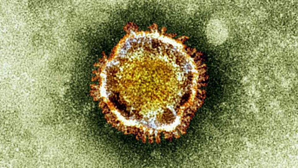 Mit dem neuen Epidemiegesetz sollen Epidemien besser bekämpft werden können. Bild: Coronavirus - auch er könnte eine neue Epidemie auslösen.