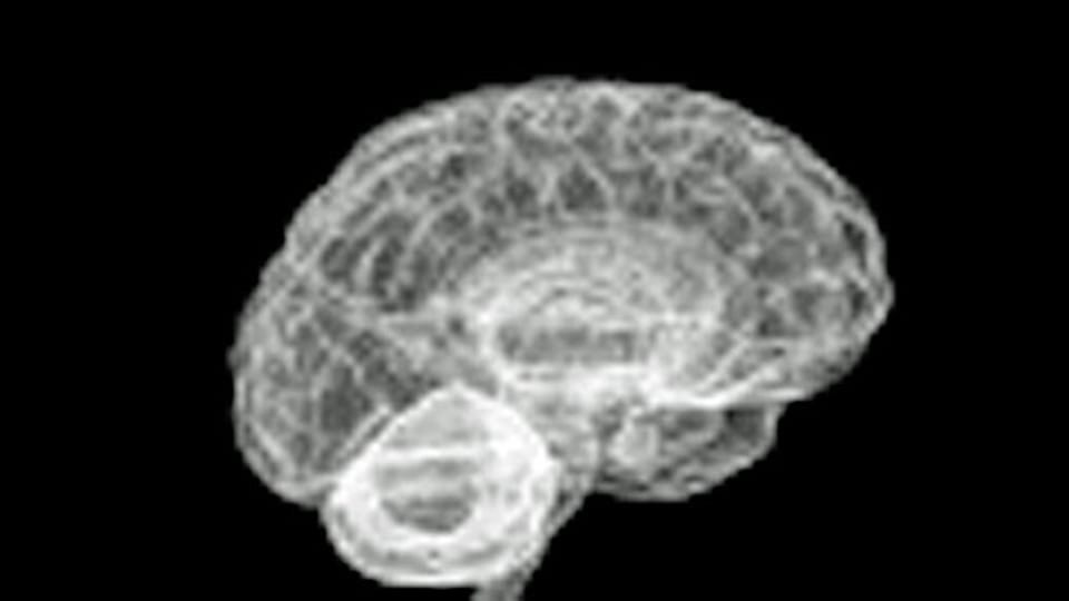 Vorzeige-Projekt im Gegenwind: Über 200 Wissenschaftler kritisieren den Forschungsansatz des milliardenteuren Human-Brain-Projects.