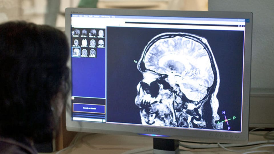 Neurowissenschaftler der Universität Zürich überwachen die Hirnaktivität eines Probanden. Symbolbild.