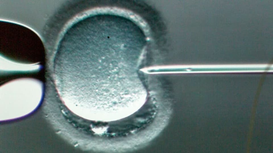 Injektion eines Spermatozon in eine Eizelle.