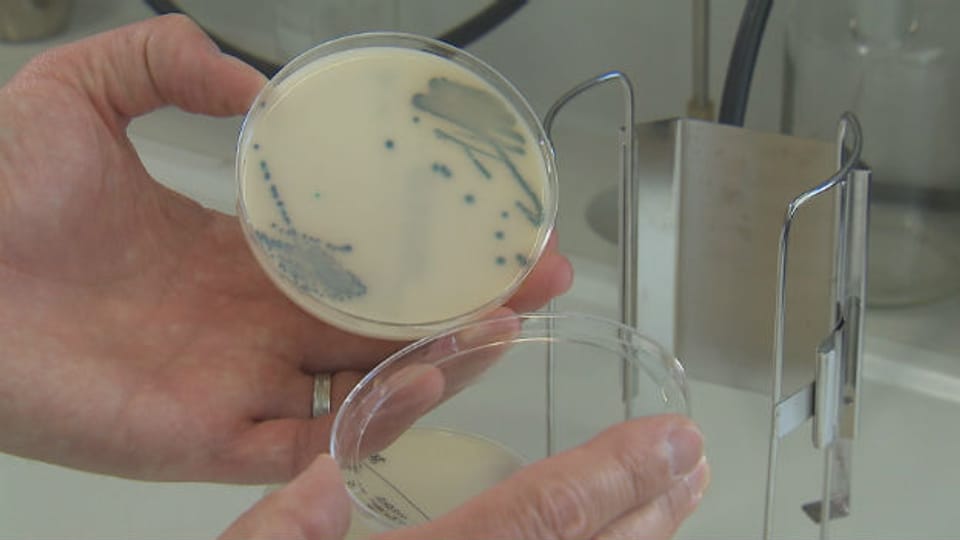 Diese Probe zeigt antibiotikaresistente Keime (dunkle Verfärbung)