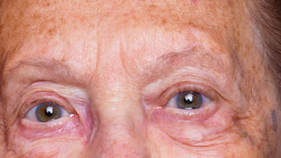 Hautflecken gelten als Zeichen des Alters.