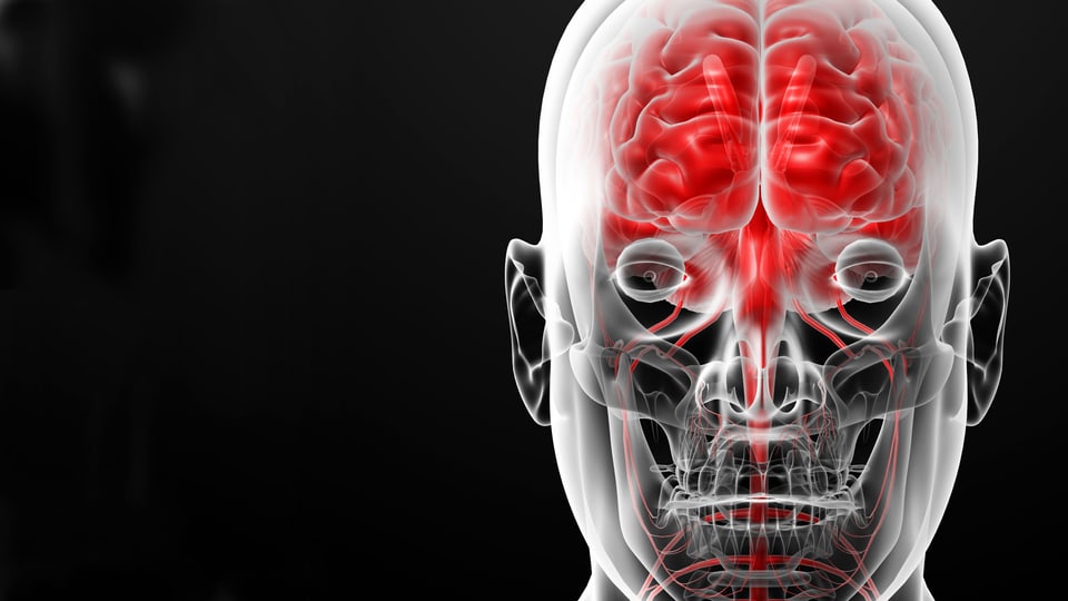 Grafik eines Schädels, rot gekennzeichnet hinter der Stirn liegt der präfrontale Cortex.