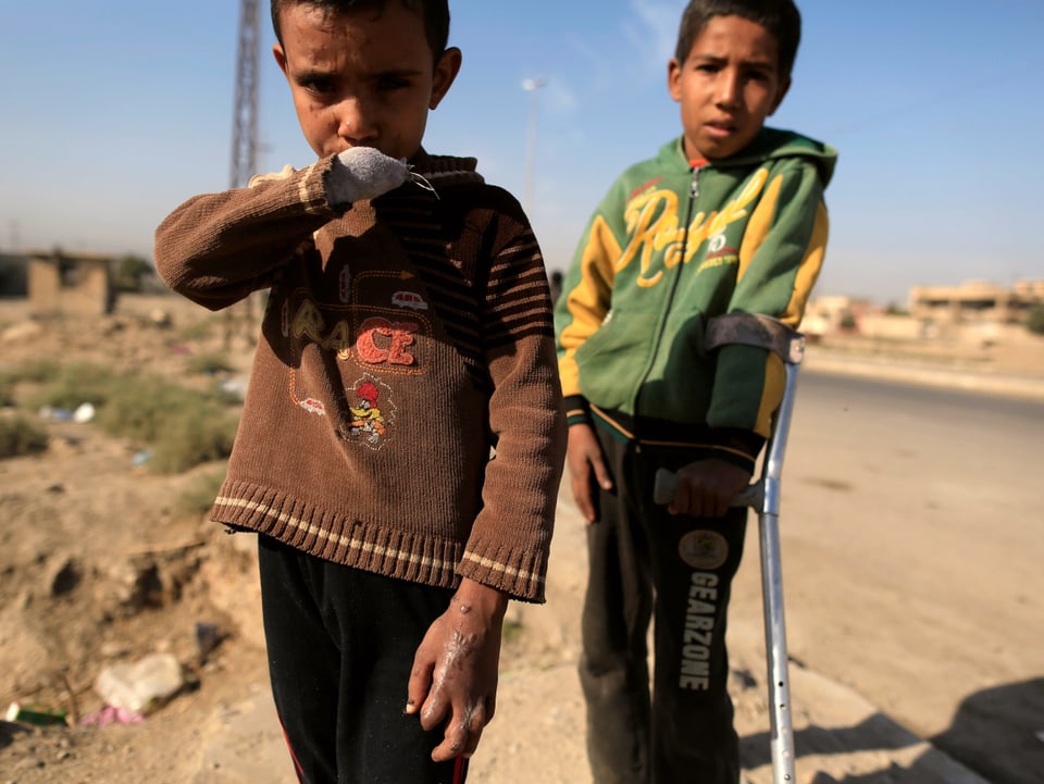 Kinder mit Kriegsverletzungen.