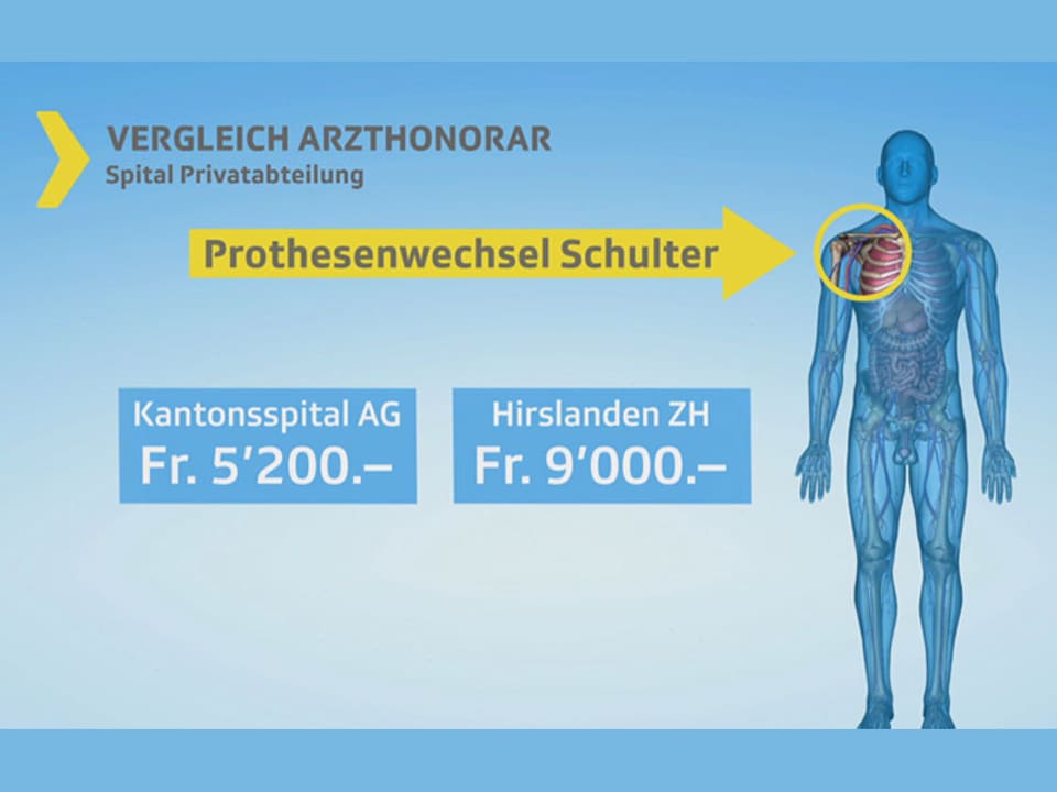 Grafik Preisvergleich Kantonsspital Hirslanden.