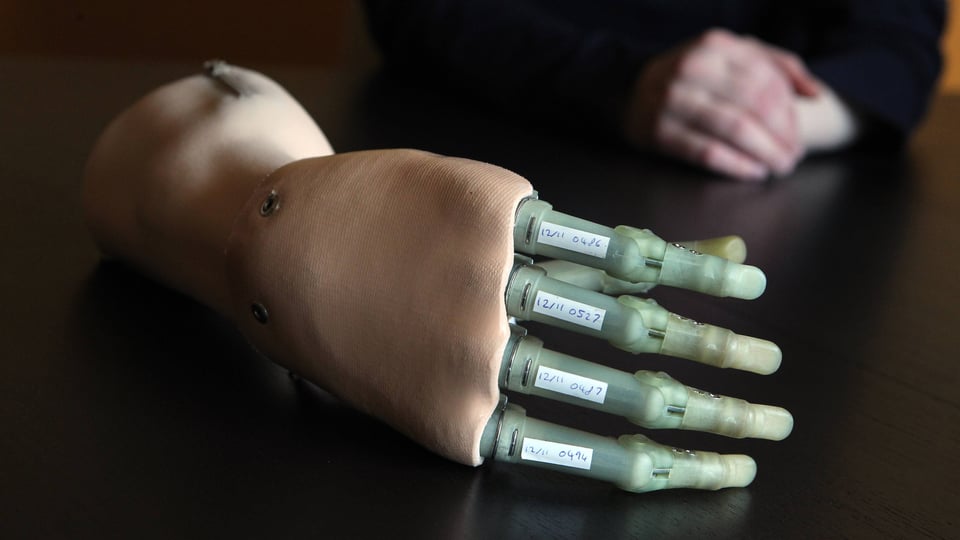 Bionische Handprothese.