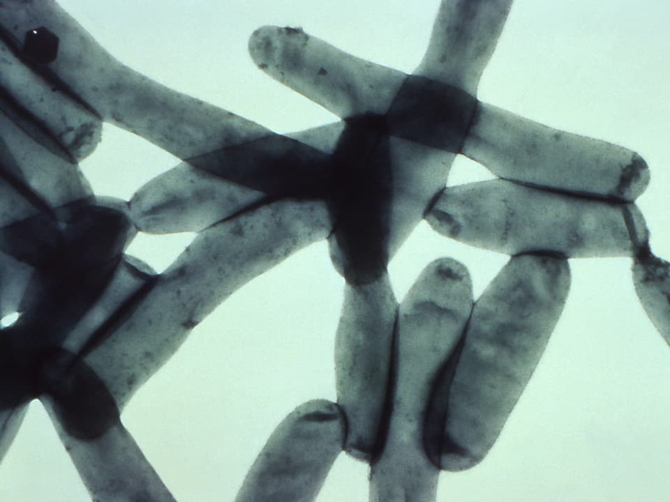 Stäbchenbakterien unterm Mikroskop